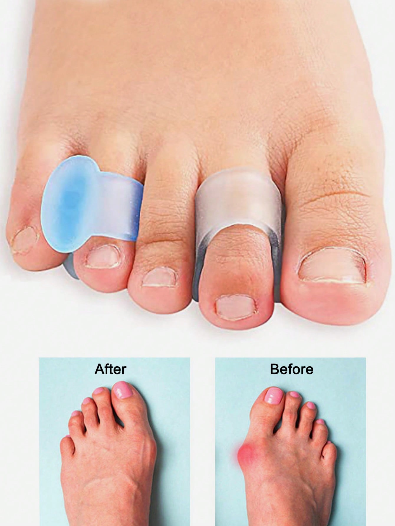 ตัวแยกนิ้วเท้าแบบเจล, ชุด 4 ชิ - Yoga Toe Separator บทวิจารณ์และราคา